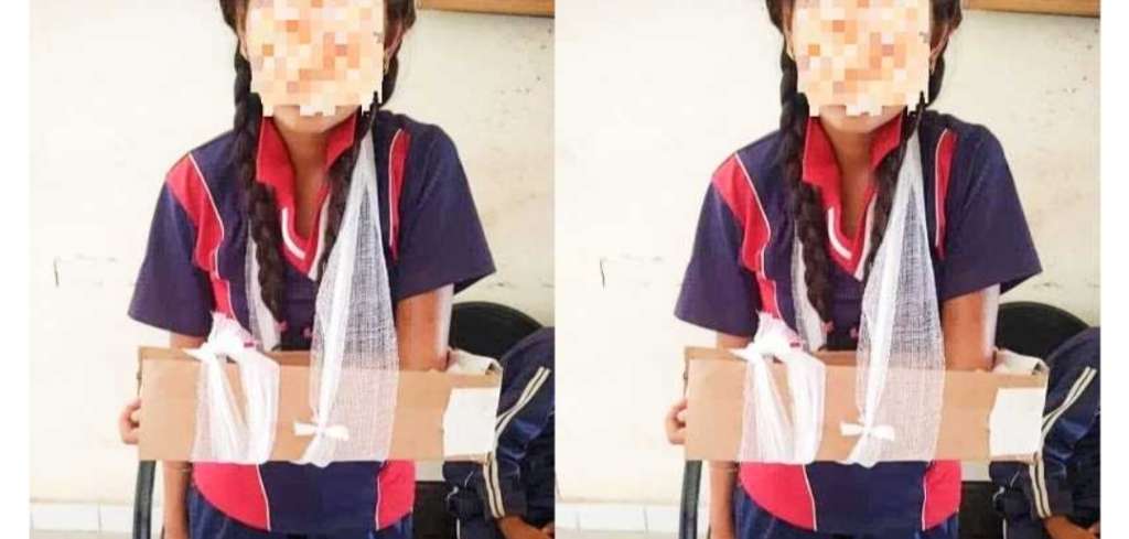 बच्ची को लगा दिया गत्ते का प्लास्टर, सोशल मीडिया नेताओं पर टूट पड़ा